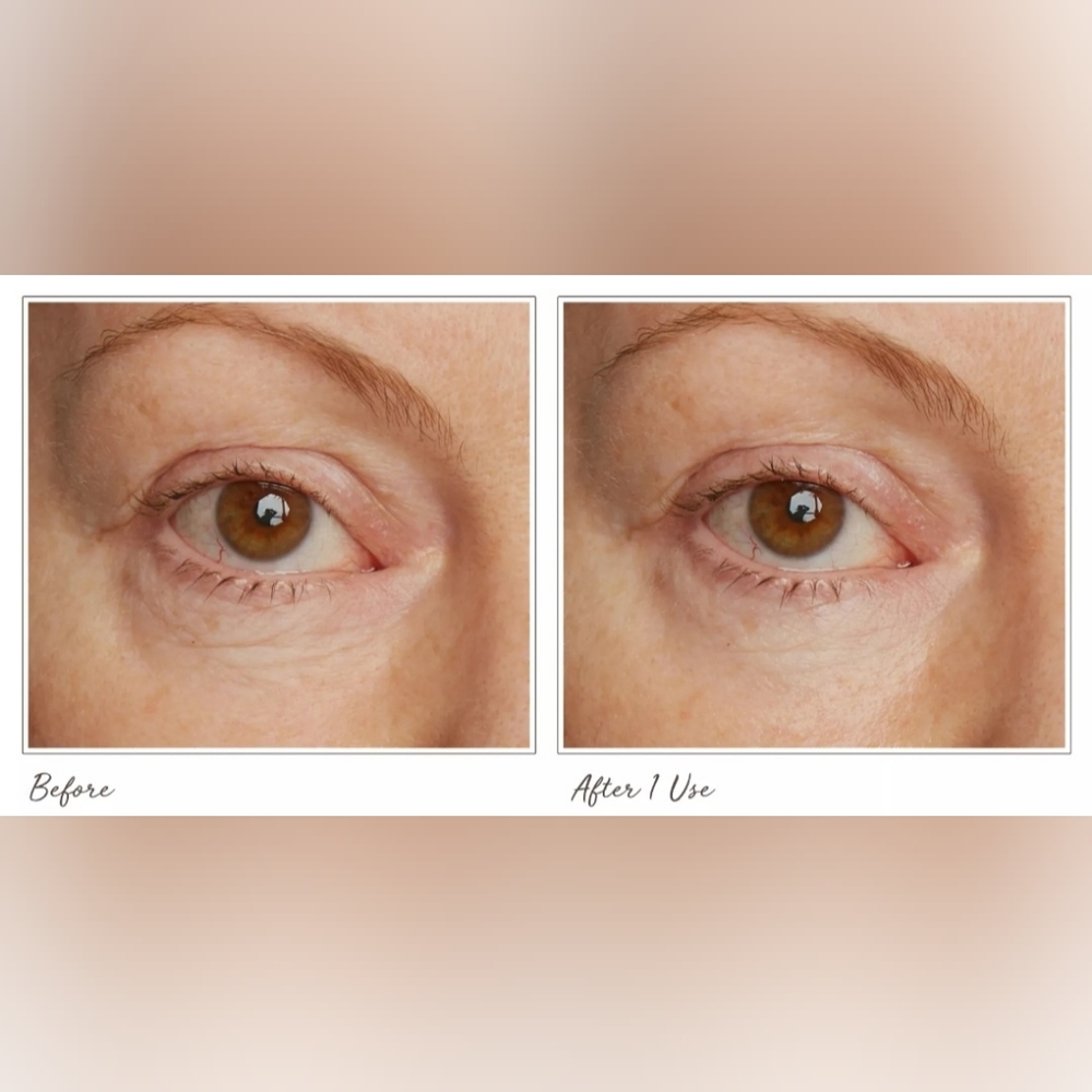 Filorga Optim Eyes - Picture 5 of 5